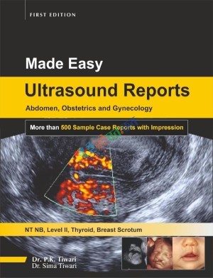 Made Easy Ultrasound Reports (Color)