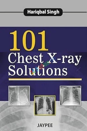 101 Chest X-ray Solutions (Color)