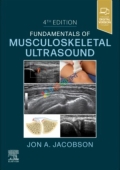 Fundamentals of Musculoskeletal Ultrasound (Color)