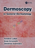 Dermoscopy in General Dermatology (B&W)