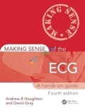 Making Sense of the ECG A Hands-on Guide (Color)