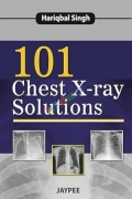 101 Chest X-ray Solutions (Color)