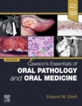 Cawson's Essentials of Oral Pathology and Oral Medicine (Color)